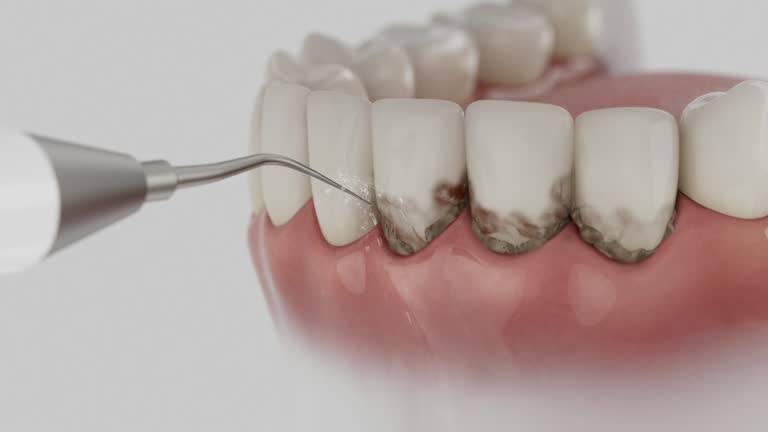 Reliable Dental Implants contractor in Shelley, ID by Smile Center Dentistry